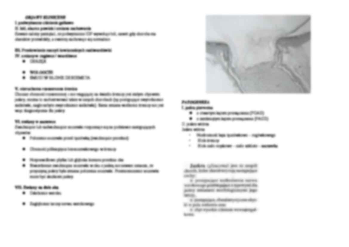 Jaskra (glaucoma) - strona 2