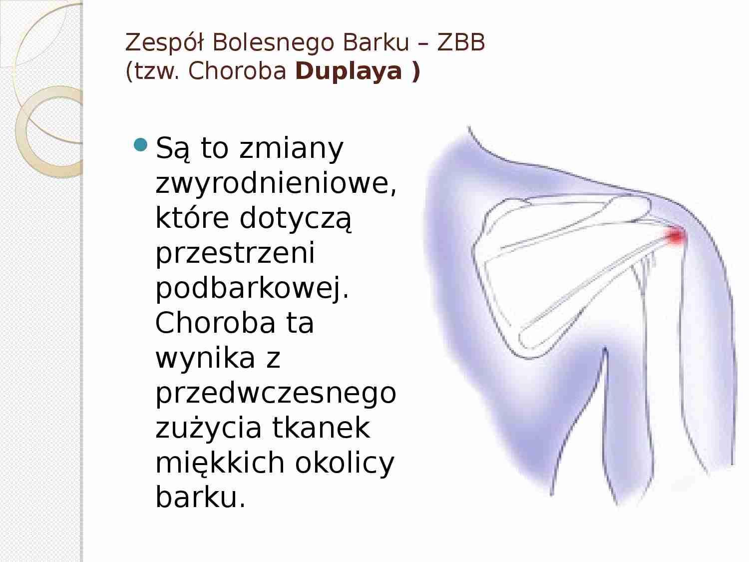 Zespół Bolesnego Barku 2 - strona 1