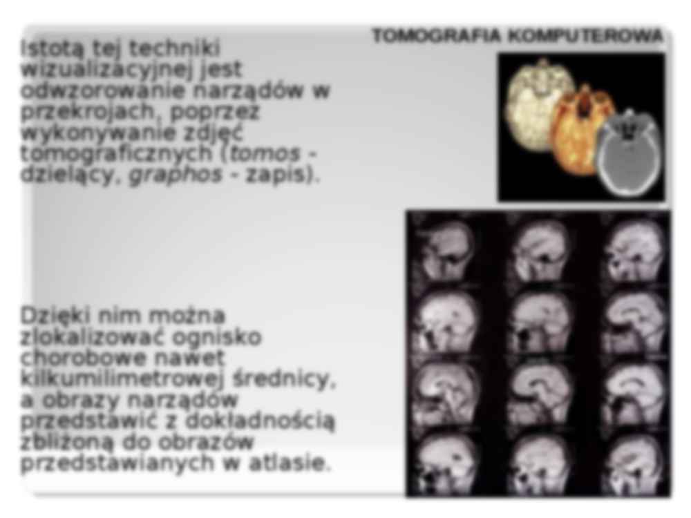 Tomografia komputerowa - prezentacja - strona 2